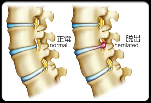 图片来自：medicinenet.com。